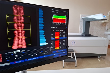 Profilaktyka i wczesne wykrywanie osteoporozy wśród mieszkańców Miasta Słupska na lata 2024-2027